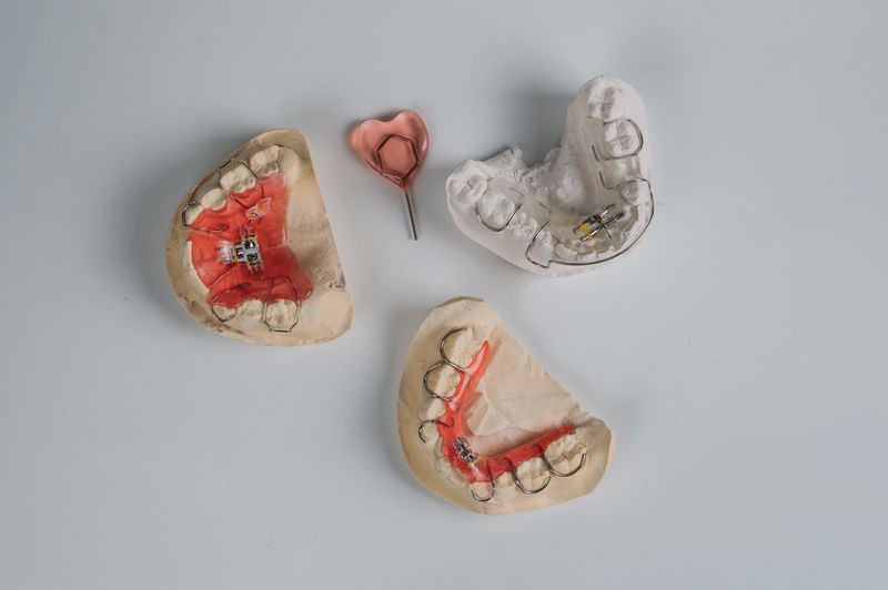 Снимать ли зубные протезы на ночь. Бюгельный протез МК-1 односторонний. Нейлоновый бюгельный протез. Бюгельный протез зубов на верхнюю челюсть. Полиуретановый бюгельный протез.